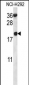 RPS12 Antibody (N-term)
